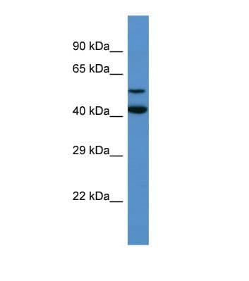 GADL1 Antibody (aa351-400)