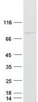Human MAATS1 Protein (Recombinant Myc-DDK (Flag))