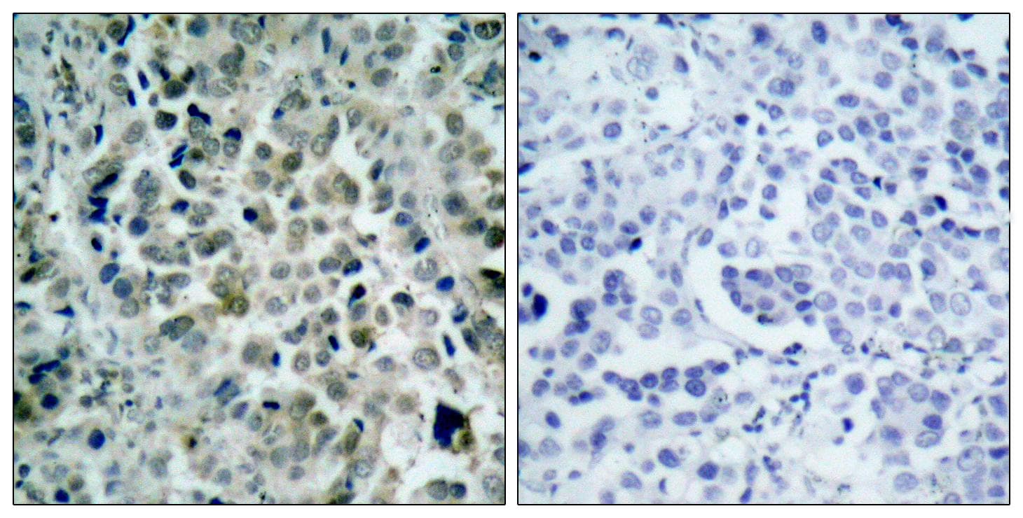 HDAC8 Antibody (p39)