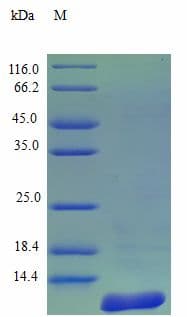 Human CCL7 / MCP3 Protein (Recombinant)