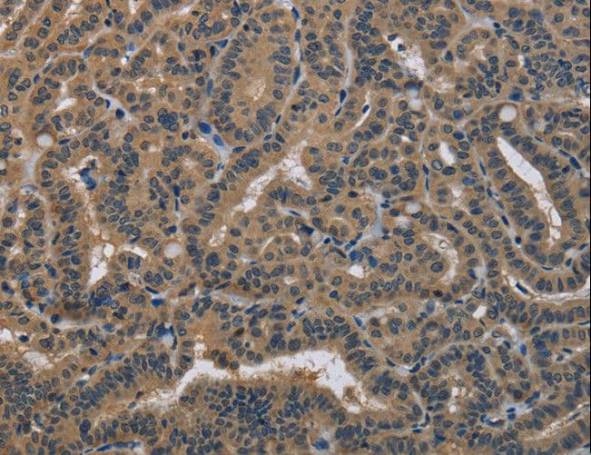 Polyclonal Rabbit anti-Human DNAJA1 / HDJ2 Antibody (IHC, WB)