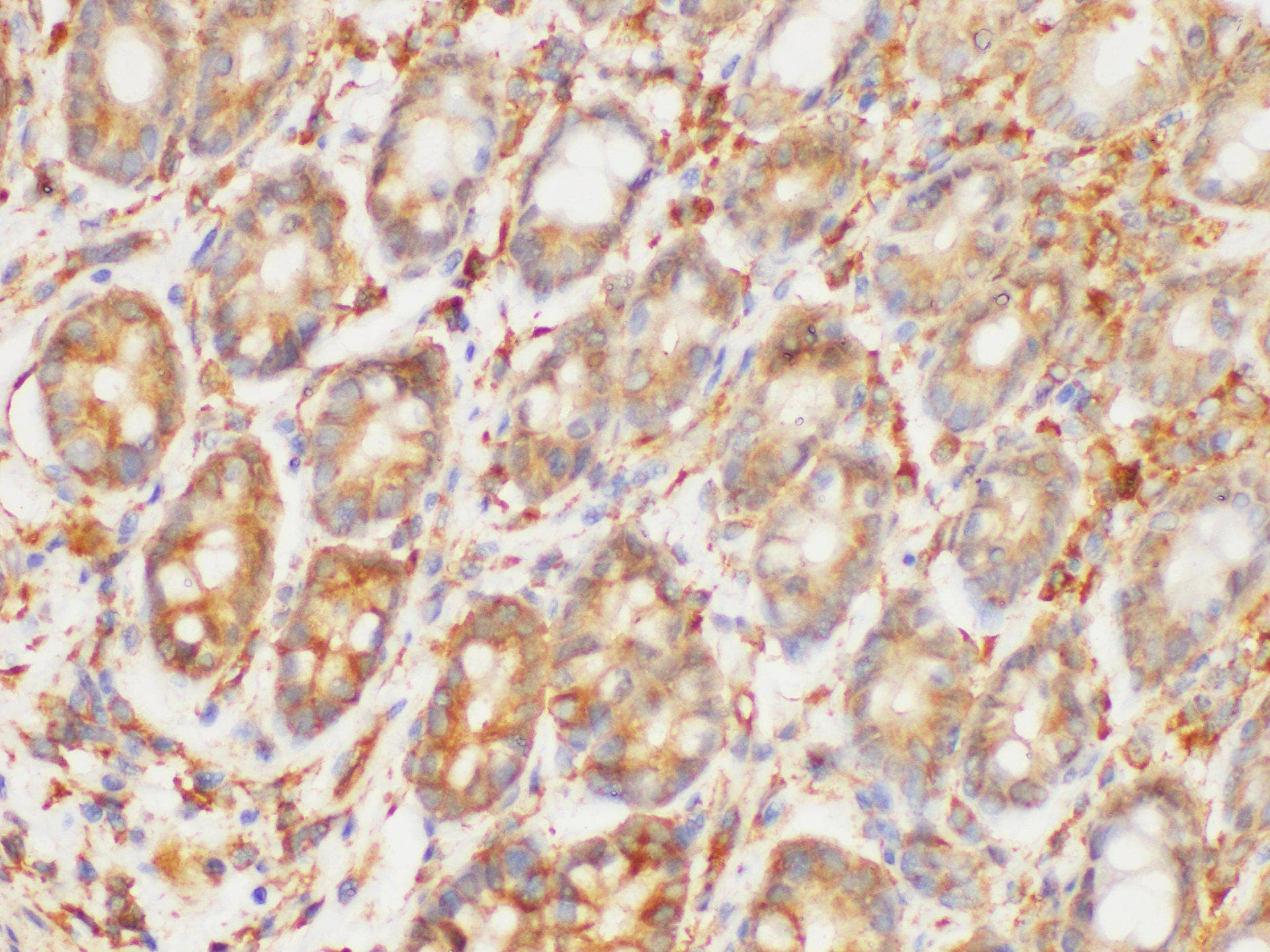 HRAS / H-Ras Antibody