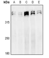 MKI67 / Ki67 Antibody