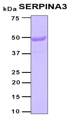 Human Alpha-1-Antichymotrypsin Protein (Recombinant 6His, N-terminus)
