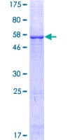 Human VDAC3 Protein (Recombinant GST)