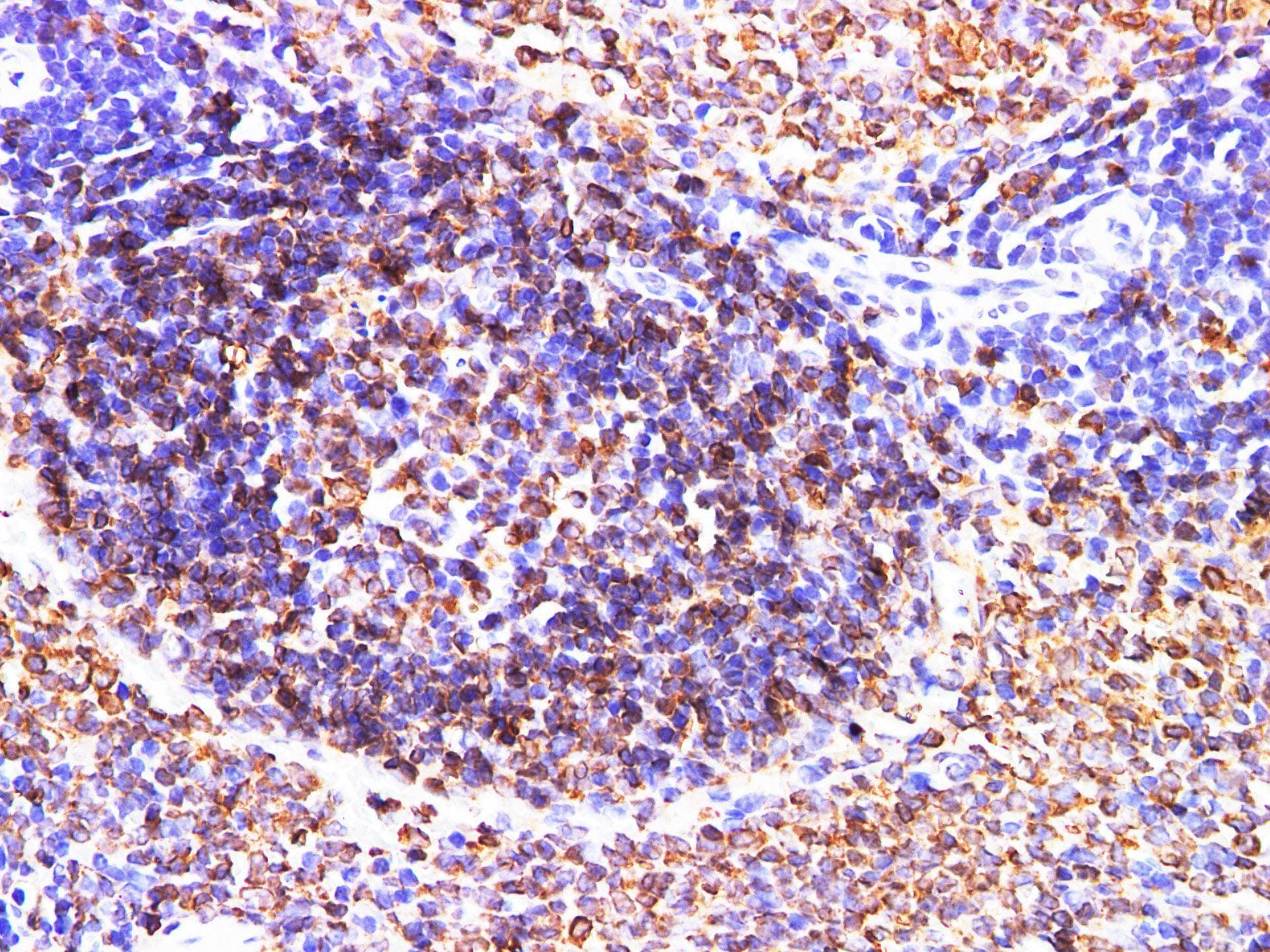CD74 / CLIP Antibody
