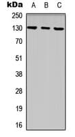 EPHB1 / EPH Receptor B1 Antibody (C-Terminus)