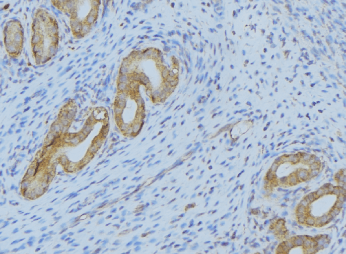 SERPING1 / C1 Inhibitor Antibody