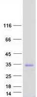 Human TMUB1 Protein (Recombinant Myc-DDK (Flag))
