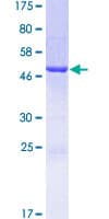 Human GSTA5 Protein (Recombinant GST)