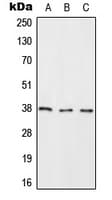 RASSF2 Antibody (Internal)