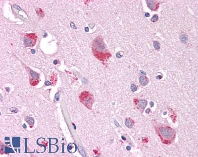 IHC-plus™ Polyclonal Rabbit anti-Human ARHGEF28 Antibody (aa1655-1705, IHC, WB)