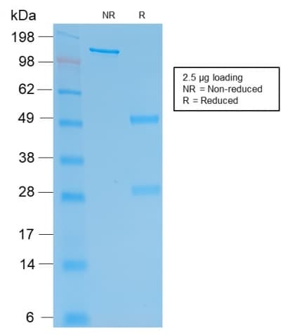 PathPlus™ CGB / hCG Beta Antibody (clone rHCGb/54)