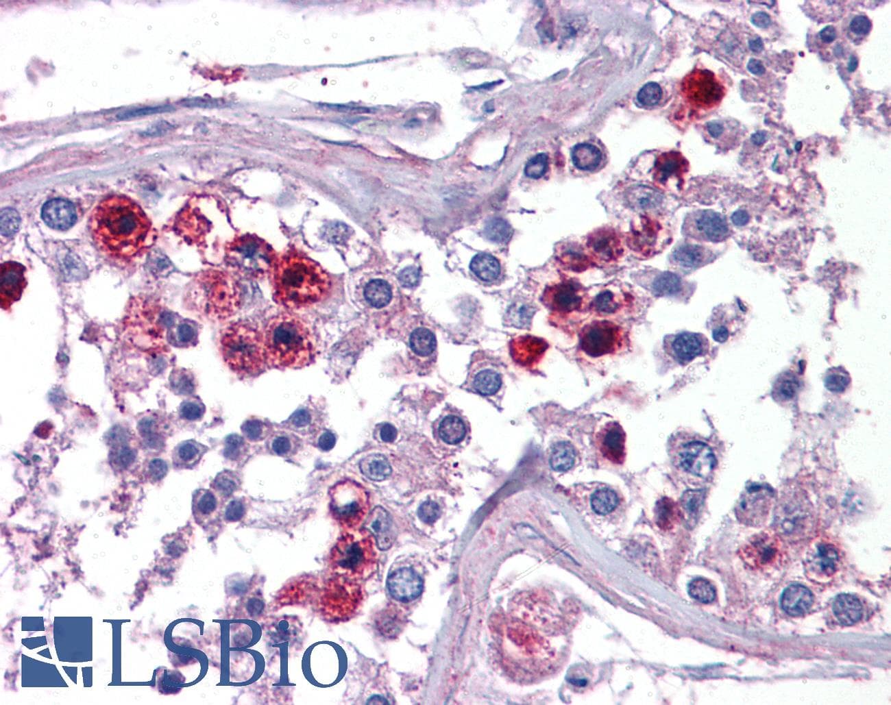 IHC-plus™ Polyclonal Rabbit anti-Human RAMA1 / SKA3 Antibody (IHC, WB)