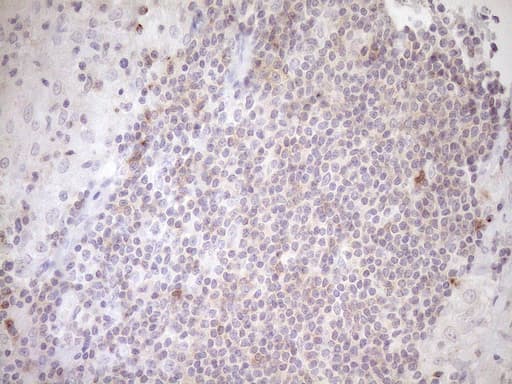 TRB3 / TRIB3 Antibody (aa1-200, clone OTI2D11, Carrier-free)