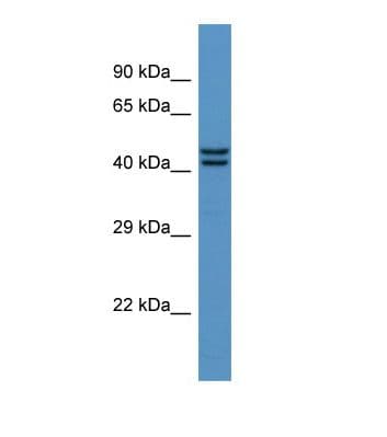 GPS1 / CSN1 Antibody (aa120-169)