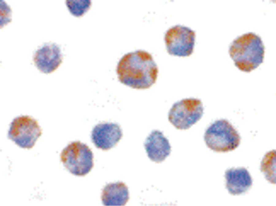 IHC-plus™ Polyclonal Rabbit anti-Human NALP1 / NLRP1 Antibody (IHC, IF, WB)
