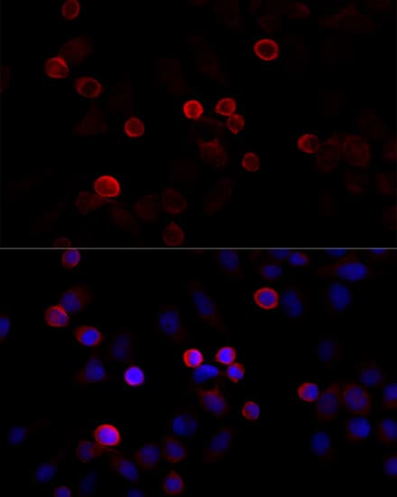 ABP-280 / FLNC Antibody