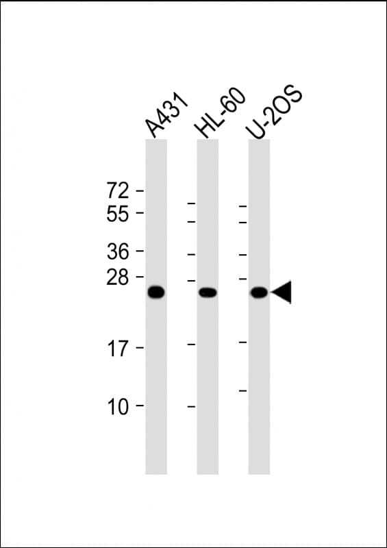 Monoclonal Mouse anti-Human RAB5C Antibody (clone 1616CT314.65.31, WB)