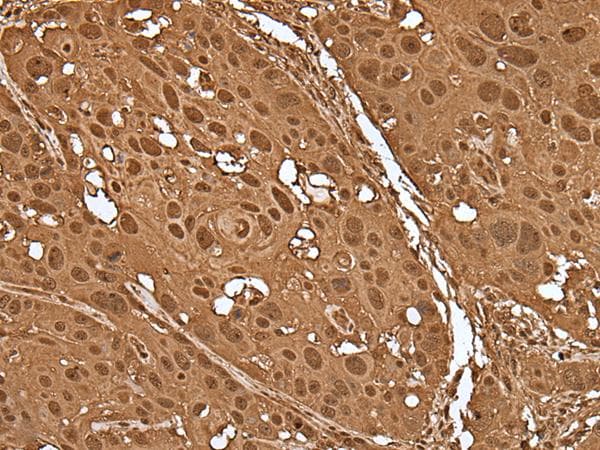 VCP Antibody