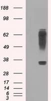 RNF144B Antibody (clone OTI9H10)