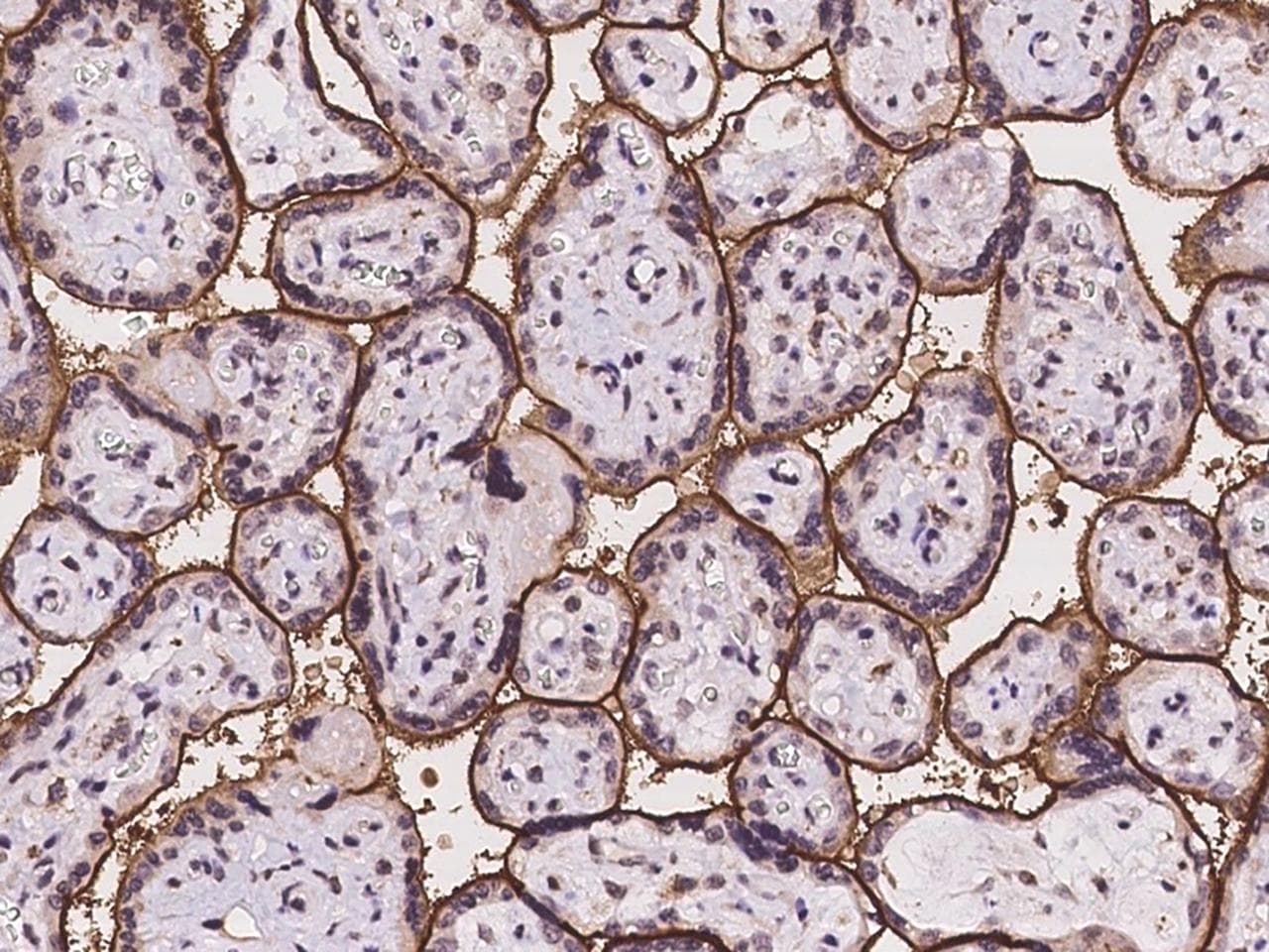 SLC39A8 / ZIP8 Antibody