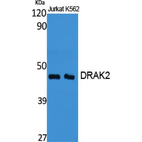 STK17B / DRAK2 Antibody (220-300 aa, Internal)