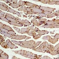 TUBB2A / Tubulin Beta 2A Antibody
