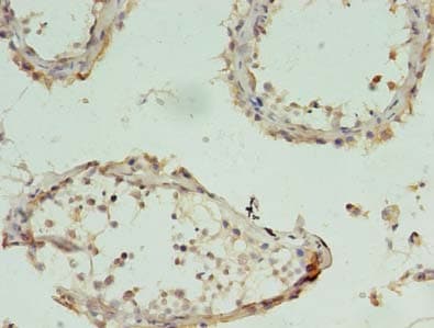 CHAC1 / MGC4504 Antibody