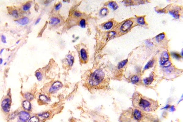 Polyclonal Rabbit anti-Human EIF4E Antibody (phospho-Ser209, IHC, WB)