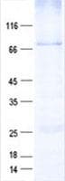 Human UGT1A9 Protein (Recombinant GST, N-terminus + His, C-terminus)