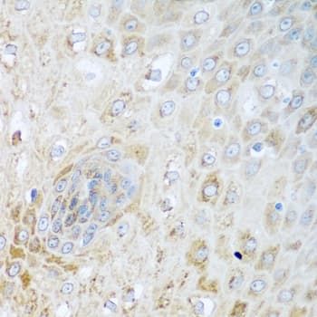 SIRT3 / Sirtuin 3 Antibody