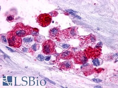 PathPlus™ Polyclonal Rabbit anti-Human PTGER3 / EP3 Antibody (N-Terminus, IHC)