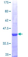 Human PRTN3 / Myeloblastin Protein (Recombinant GST, N-terminus)