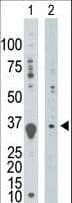 DGUOK / Deoxyguanosine Kinase Antibody (aa241-271)