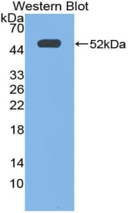 PTGER3 / EP3 Antibody (aa217-390)