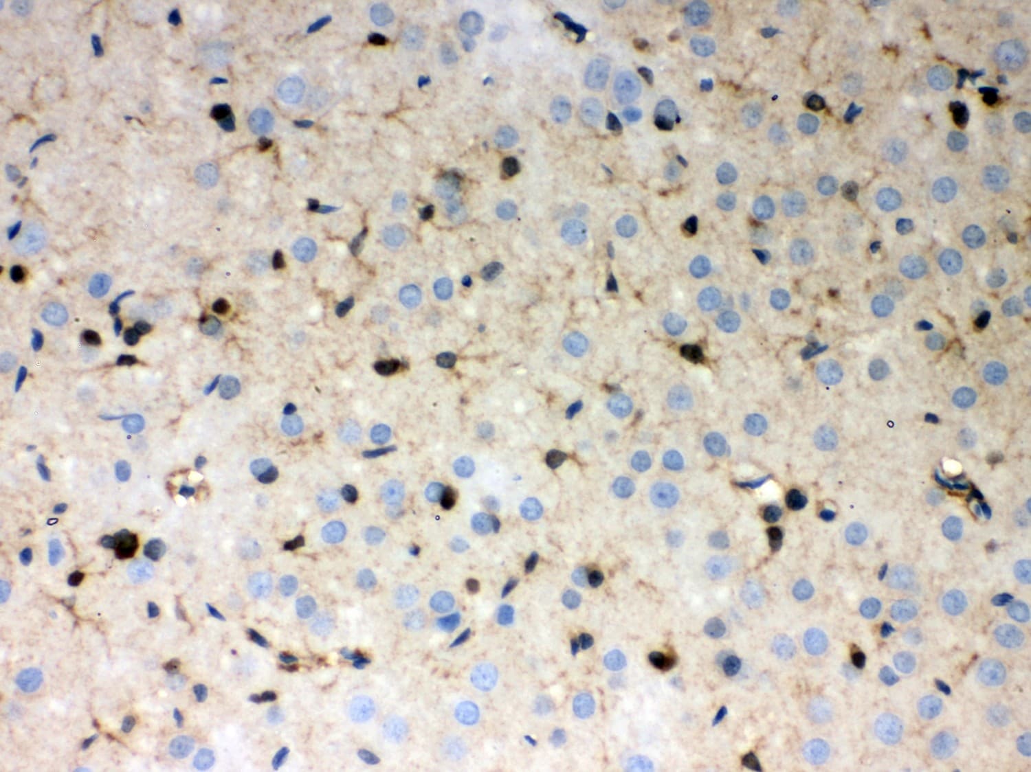 PRDX1 / Peroxiredoxin 1 Antibody (aa100-128)