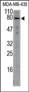 CAPN5 / Calpain 5 Antibody