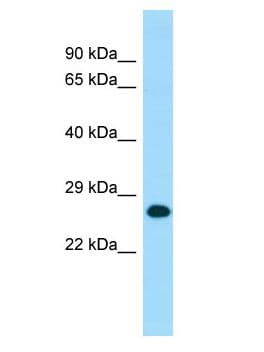 MOB1A Antibody (aa167-216)