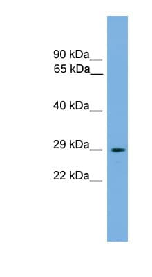 NRIP2 Antibody (N-Terminus)