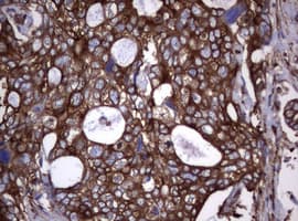 CD30 Antibody (clone OTI16H5)