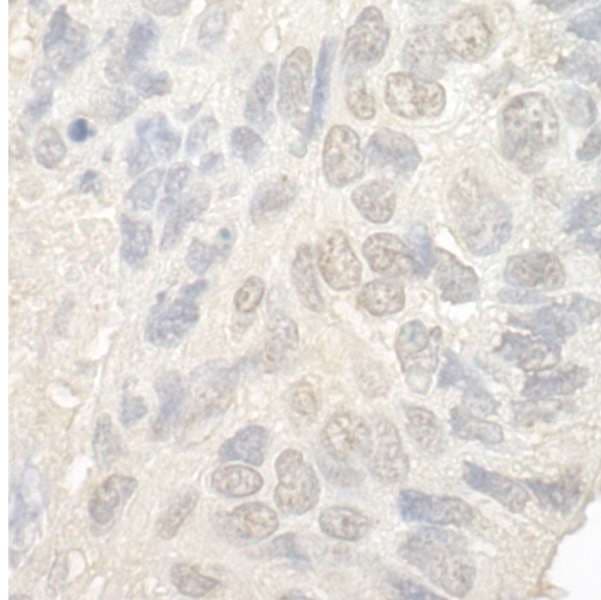 NOL12 Antibody (aa163-213)