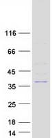 Human ELMOD1 Protein (Recombinant Myc-DDK (Flag))