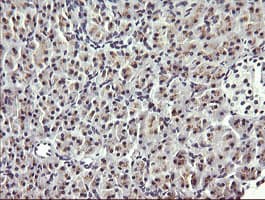 HRAS / H-Ras Antibody (clone OTI2A1)