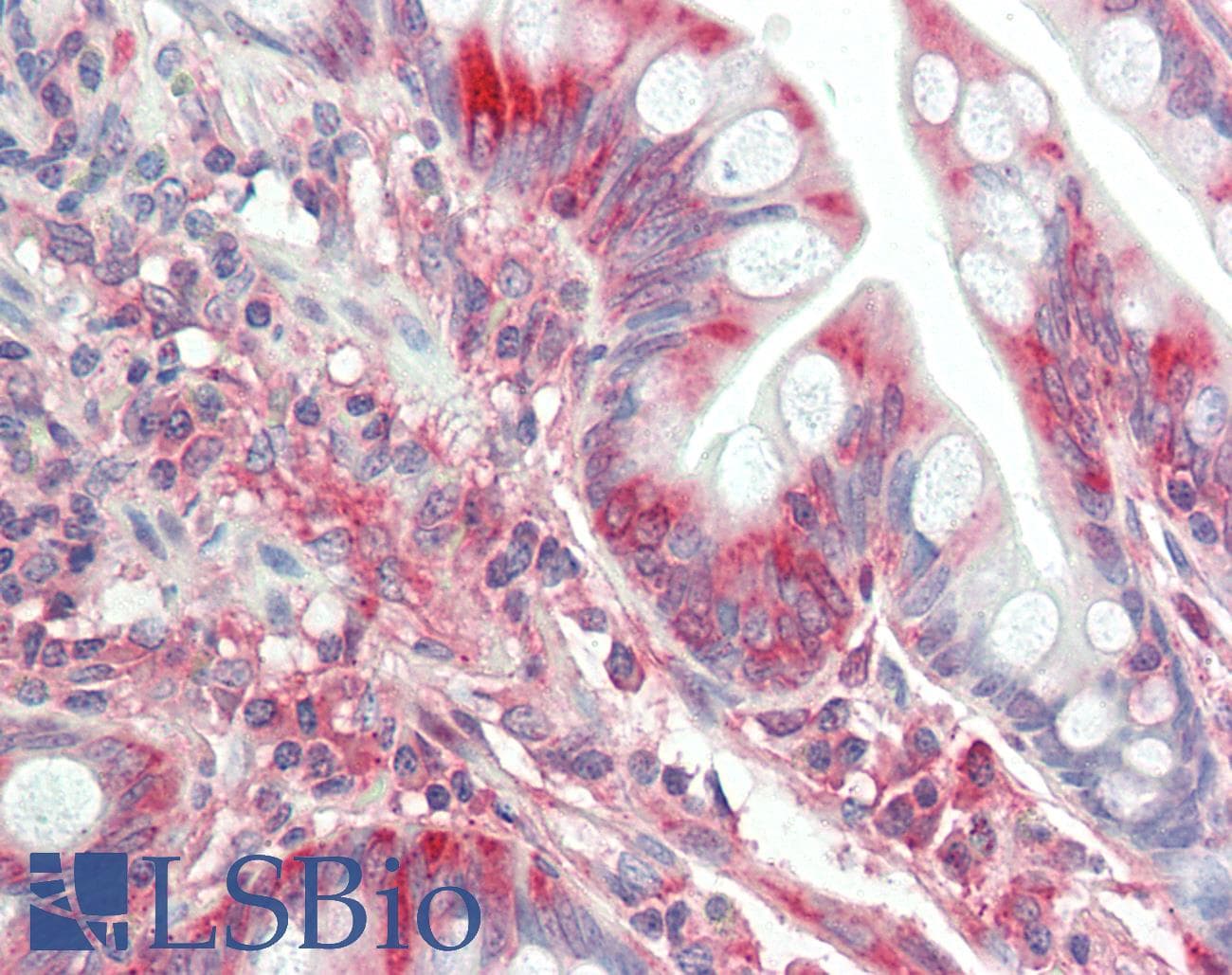 IHC-plus™ Monoclonal Mouse anti-Human TFG Antibody (clone TFG-03, IHC, WB)