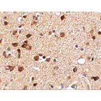 STK39 / SPAK Antibody