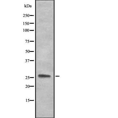 Complement C1QA Antibody