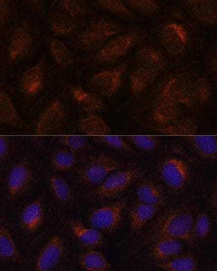 AGR2 Antibody