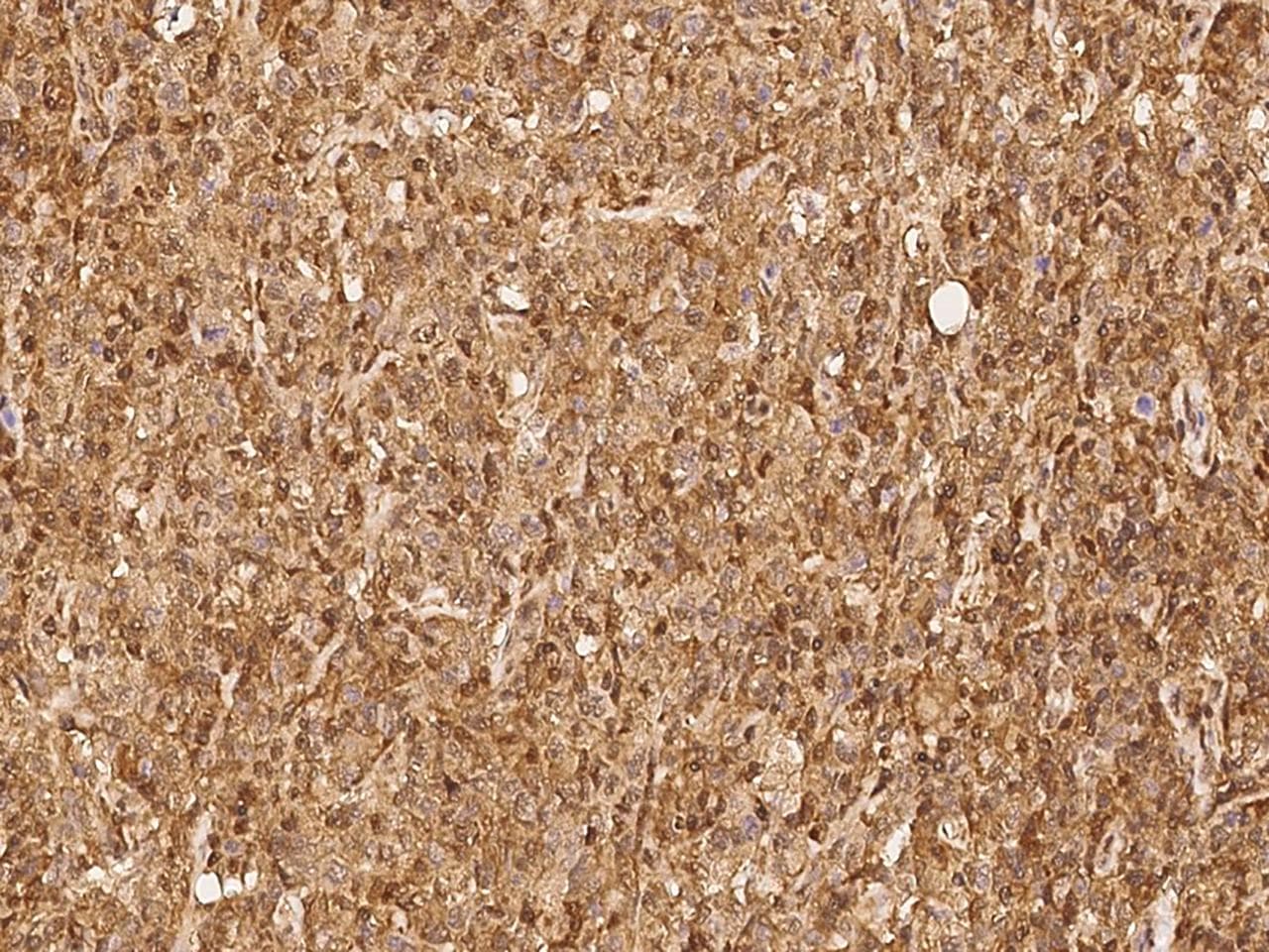 PSMB8 / LMP7 Antibody (Preservative Free)