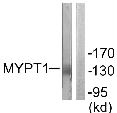 PPP1R12A / MYPT1 Antibody (aa621-670)